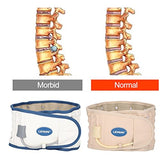 Cinturón de Descompresión Lumbar Physio Ajustable, Postura de la Correa de Cintura Inflable Dispositivo de tracción de Disco para Corrector de Soporte Lumbar para Hombres y Mujeres(Blanco)